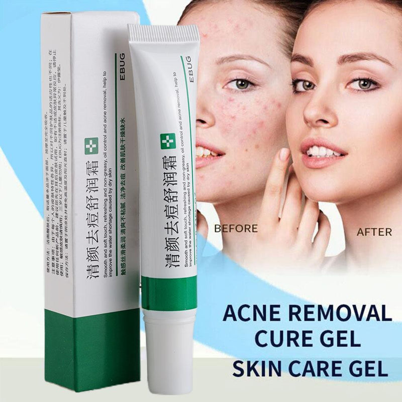 20g Acne Removal Cream Acne Treatment Fade Acne Spots Freckle Cream Oil Control Shrink Pores Whitening Moisturizing Skin Care