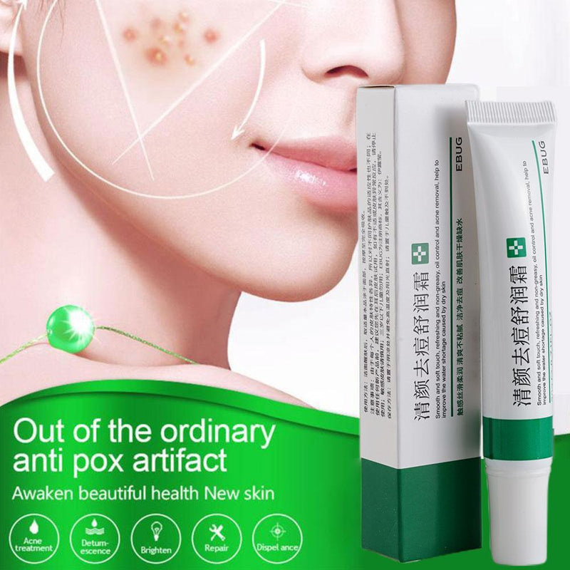 20g Acne Removal Cream Acne Treatment Fade Acne Spots Freckle Cream Oil Control Shrink Pores Whitening Moisturizing Skin Care