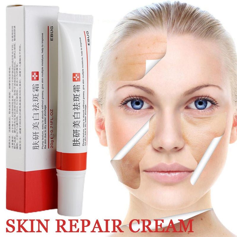 20g Acne Removal Cream Acne Treatment Fade Acne Spots Freckle Cream Oil Control Shrink Pores Whitening Moisturizing Skin Care